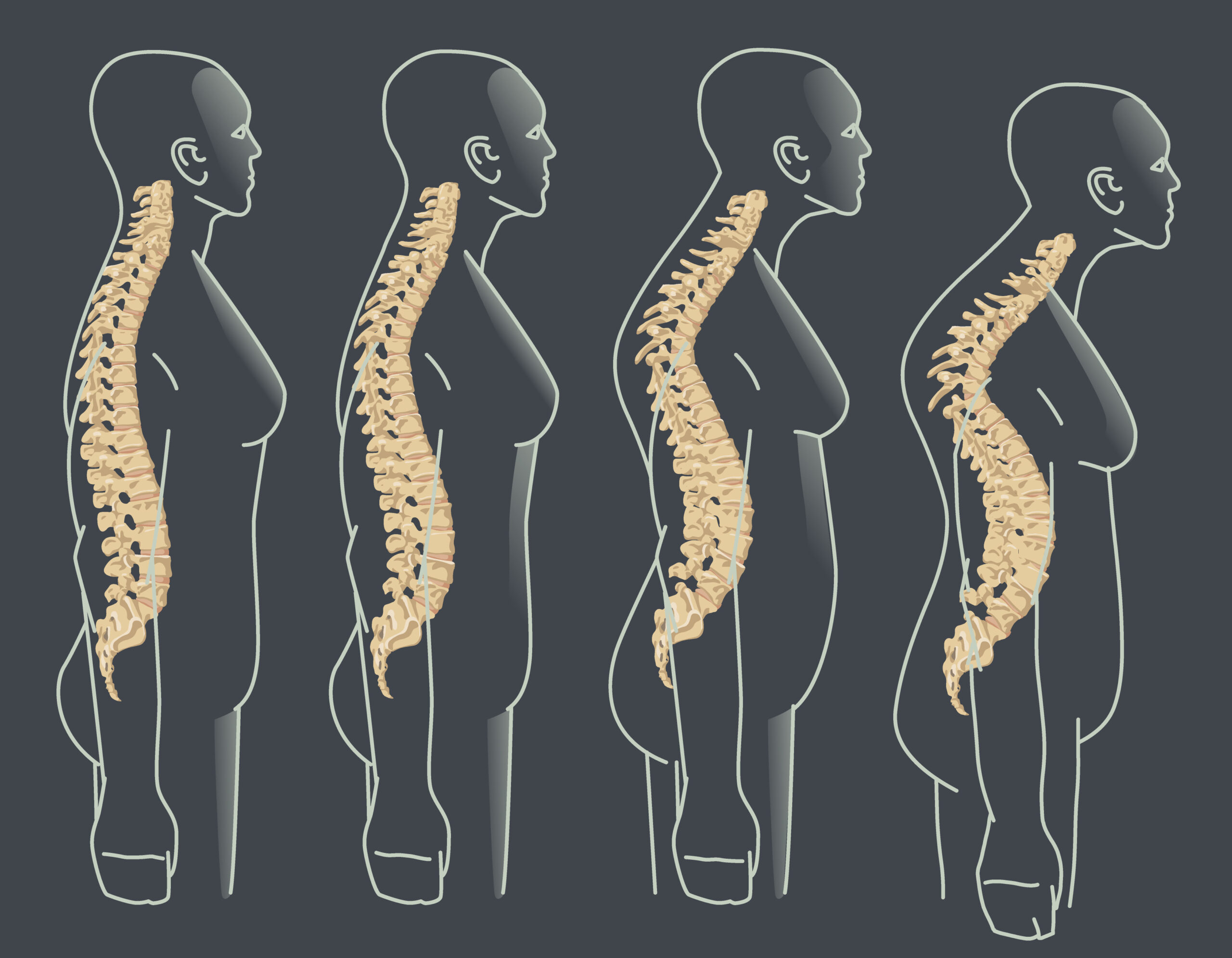 65 Yaş üstü kadınlar için osteoporoz ve kemik sağlığı 